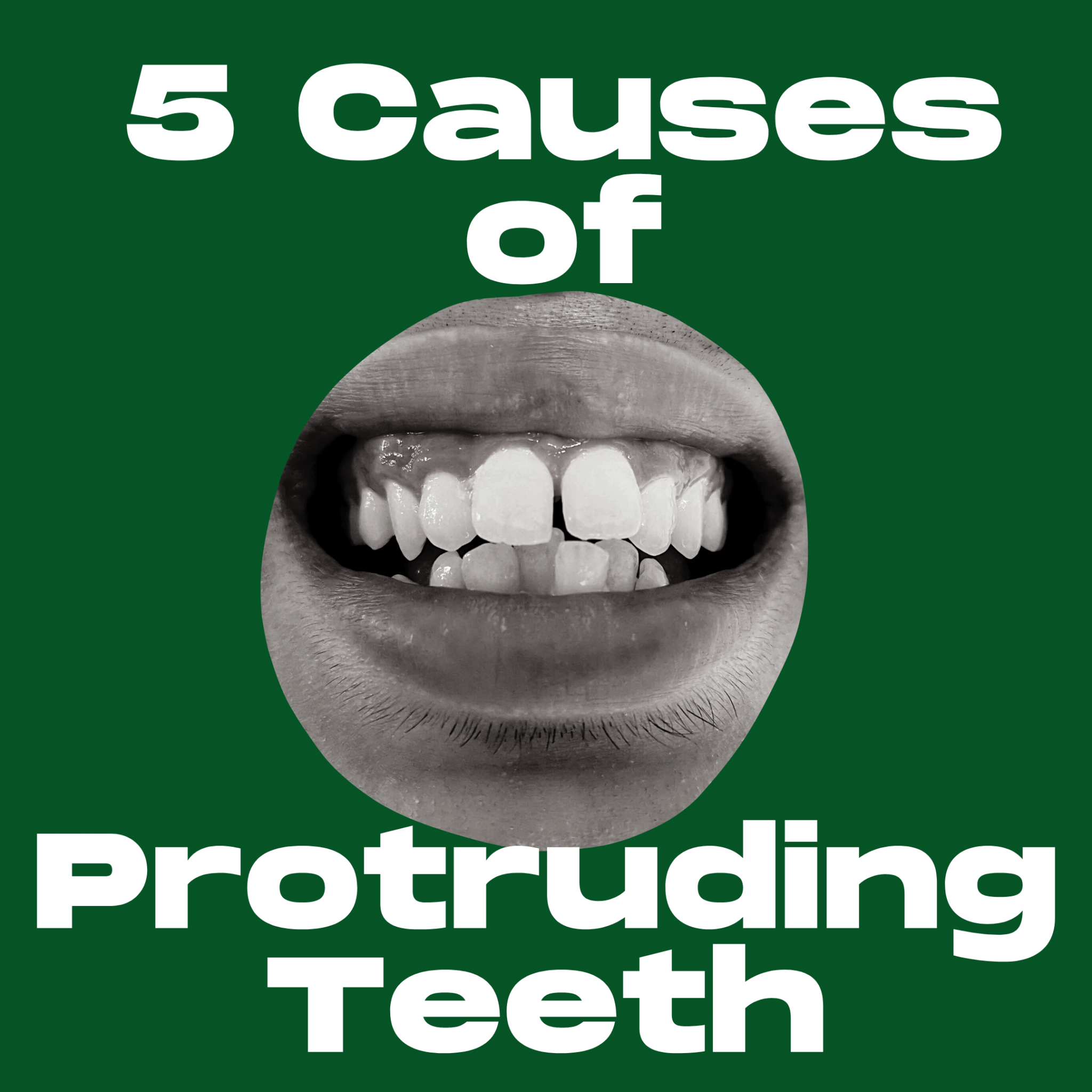 5-causes-of-protruding-teeth-acorn-dentistry-for-kids