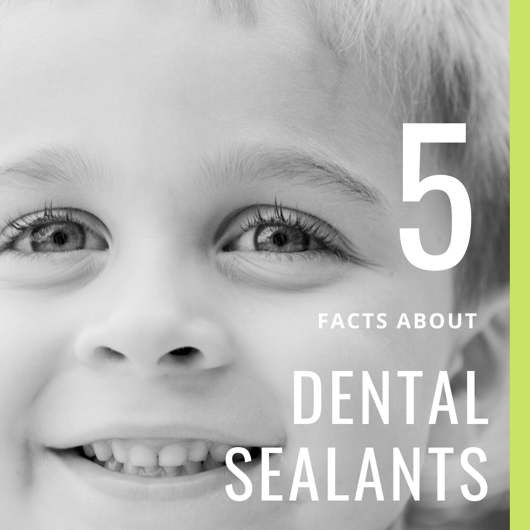5 Facts About Dental Sealants (1)