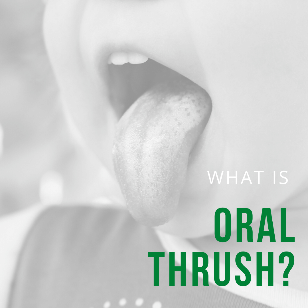 What is oral thrush