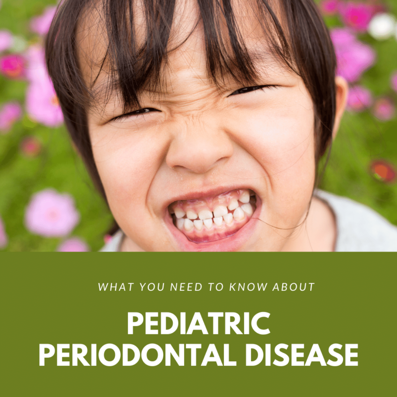 What You Need to Know About pediatric periodontal disease (1)