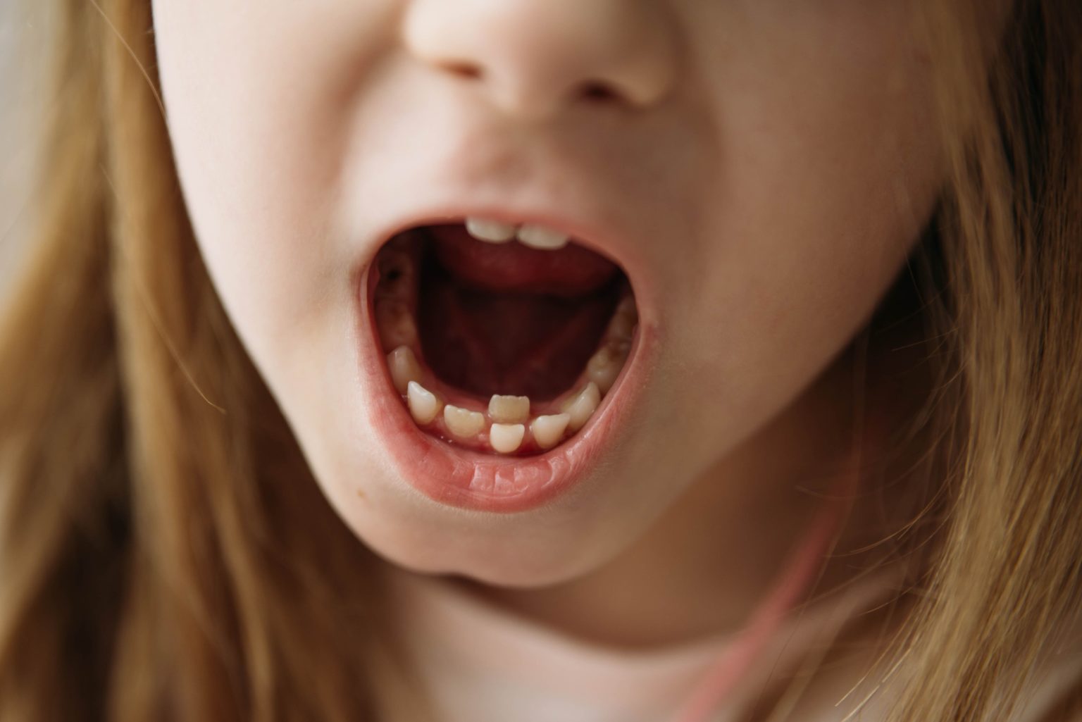 royal teeth kids conspire
